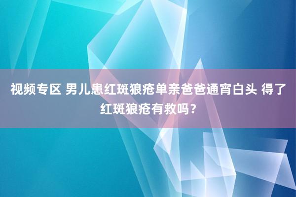 视频专区 男儿患红斑狼疮单亲爸爸通宵白头 得了红斑狼疮有救吗？